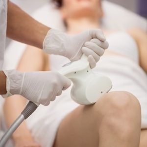 Radiofrequência Criogênica